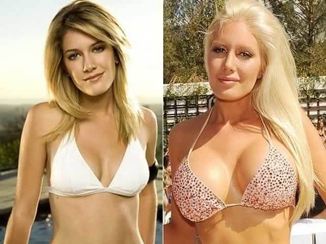 Heidi Montag – $1,000,000