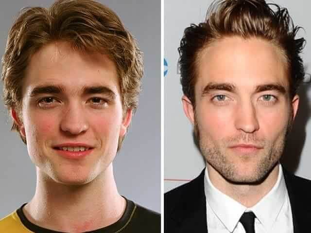 Robert Pattinson – Unknown