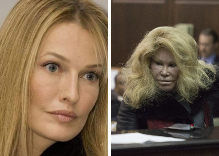 Jocelyn Wildenstein – $6.500,000