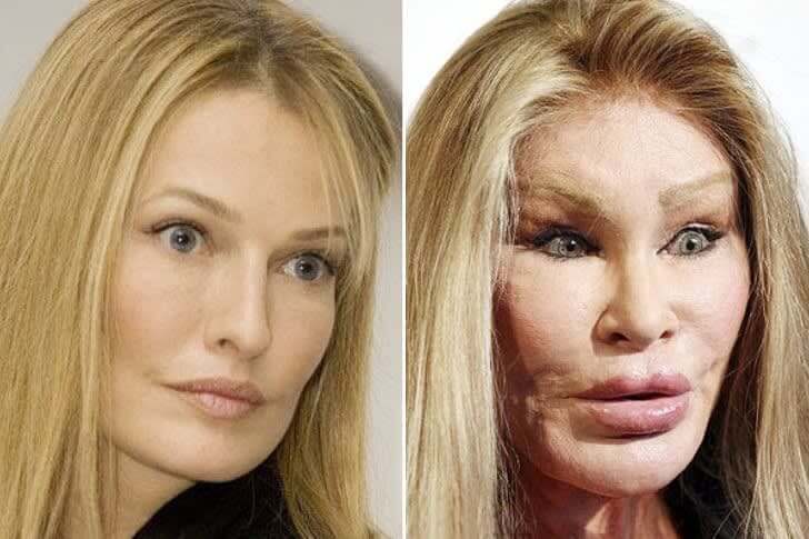 Jocelyn Wildenstein Is More Feline Than Human