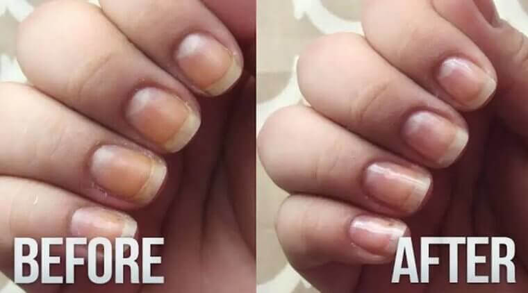 There’s a DIY Way to Get Rid of Nail Polish Stains