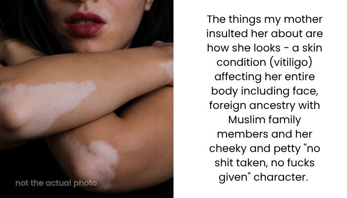 Woman Mocked Her Son’s Girlfriend’s Skin for Years, But Later Regretted Her Hurtful Comments